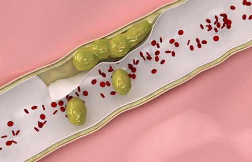 Limpieza cardiovascular remedios naturales